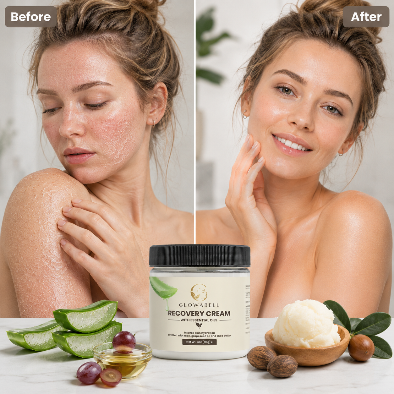 Recovery Cream